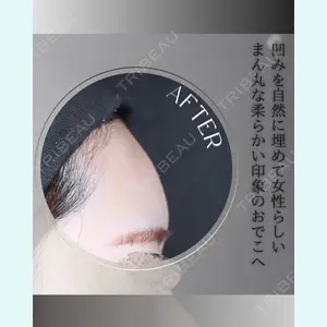 小倉美容外科/美容皮膚科 ビラビューティークリニック 大村 亞蘭医師の症例