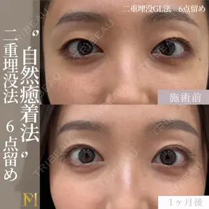 症例