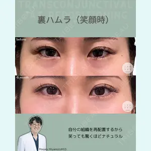 くさのたろうクリニック 宮本　大医師の症例