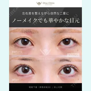 Otus Clinic 【オータスクリニック】 中 徳太郎医師の症例