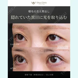 Otus Clinic 【オータスクリニック】 中 徳太郎医師の症例