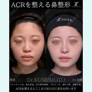 Zetith Beauty Clinic 銀座院 楠本 拓哉医師の症例