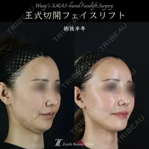 Zetith Beauty Clinic 新宿院 王 蘇医師の症例