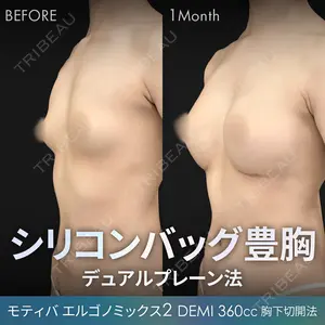 ジョウクリニック 大阪院 新開 博之医師の症例