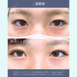 ネビュラクリニック 広島院 白岩 拓巳医師の症例