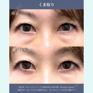 ネビュラクリニック 広島院 住尾 祥隆医師の症例