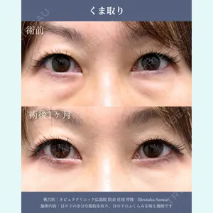 ネビュラクリニック 広島院 住尾 祥隆医師の症例