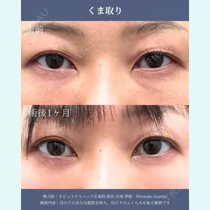 ネビュラクリニック 広島院 住尾 祥隆医師の症例