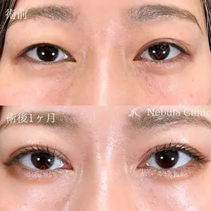 ネビュラクリニック 広島院 住尾 祥隆医師の症例