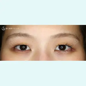 聖心美容クリニック 札幌院 前多 一彦医師の症例