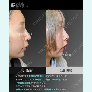 eクリニック 岡山院 田嶋 隼也医師の症例