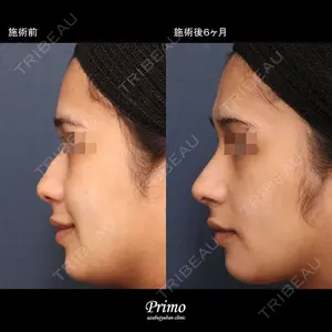 プリモ麻布十番クリニック 大場教弘医師の症例