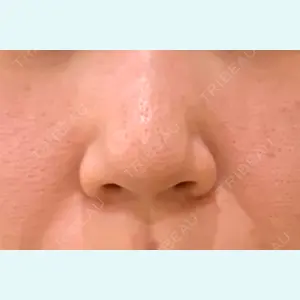 アメリクリニック福岡の症例