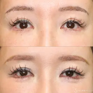 聖心美容クリニック 名古屋院 加藤 大典医師の症例