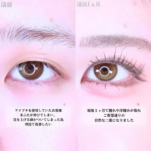 アリエル美容クリニック 水戸院 天白 典秀医師の症例