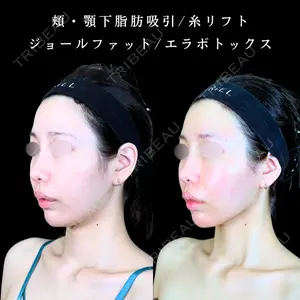 アリエル美容クリニック 大宮院 江郷隼一郎医師の症例