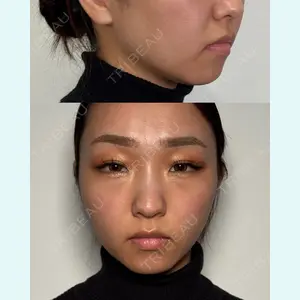 Moon Beauty Clinic 渡邉 正士医師の症例