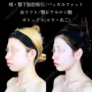 アリエル美容クリニック 大宮院 鈴木　桂介医師の症例