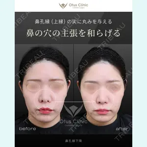 Otus Clinic 【オータスクリニック】 中 徳太郎医師の症例