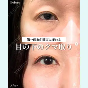 愛知春日井美容外科ネビュラクリニック 都築 諒医師の症例