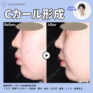 吉祥寺アイビークリニック 升本　浩紀医師の症例