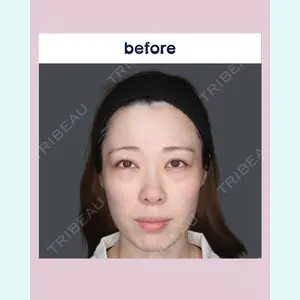 吉祥寺アイビークリニック 升本　浩紀医師の症例