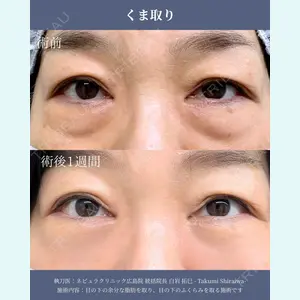 ネビュラクリニック 広島院 白岩 拓巳医師の症例