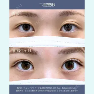 ネビュラクリニック 広島院 白岩 拓巳医師の症例