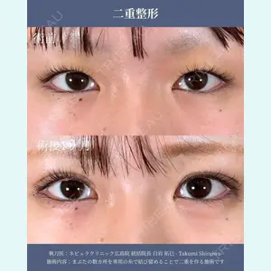 ネビュラクリニック 広島院 住尾 祥隆医師の症例