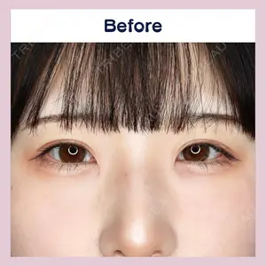 吉祥寺アイビークリニック 升本　浩紀医師の症例