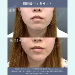 ネビュラクリニック 広島院 住尾 祥隆医師の症例