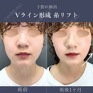 ネビュラクリニック 広島院 住尾 祥隆医師の症例