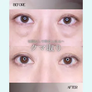 小倉美容外科/美容皮膚科 ビラビューティークリニック 大村 亞蘭医師の症例