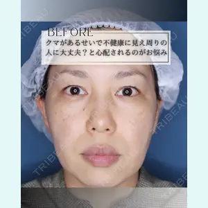 小倉美容外科/美容皮膚科 ビラビューティークリニック 大村 亞蘭医師の症例