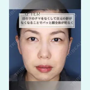 小倉美容外科/美容皮膚科 ビラビューティークリニック 大村 亞蘭医師の症例