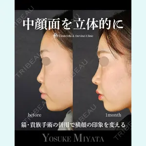 シンデレラ＆ダヴィンチクリニック 宮田 洋佑医師の症例