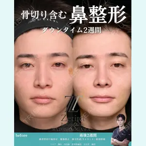 Zetith Beauty Clinic 銀座院 小川 悟史医師の症例