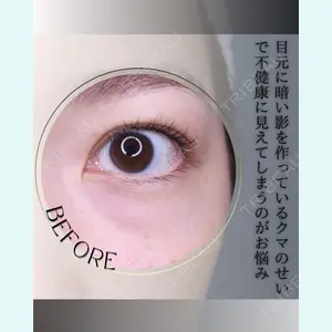 小倉美容外科/美容皮膚科 ビラビューティークリニック 大村 亞蘭医師の症例