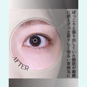 小倉美容外科/美容皮膚科 ビラビューティークリニック 大村 亞蘭医師の症例