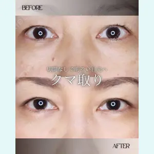 小倉美容外科/美容皮膚科 ビラビューティークリニック 大村 亞蘭医師の症例