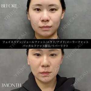 RIVER CLINIC（リバークリニック）大阪院の症例