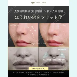 Otus Clinic 【オータスクリニック】 中 徳太郎医師の症例