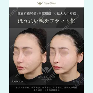 Otus Clinic 【オータスクリニック】 中 徳太郎医師の症例