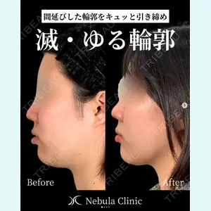 ネビュラクリニック 広島院の症例