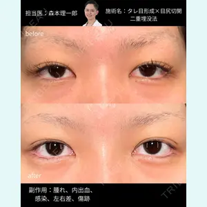 PRISM Beauty Clinic 町田院 森本 理一郎医師の症例