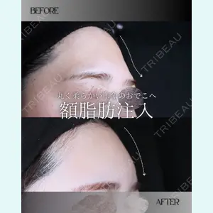 小倉美容外科/美容皮膚科 ビラビューティークリニック 大村 亞蘭医師の症例