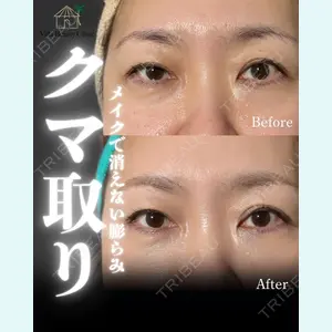 小倉美容外科/美容皮膚科 ビラビューティークリニック 大村 亞蘭医師の症例