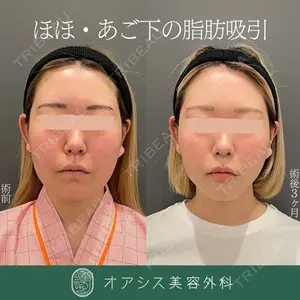 オアシス美容外科 遠藤 剛史医師の症例