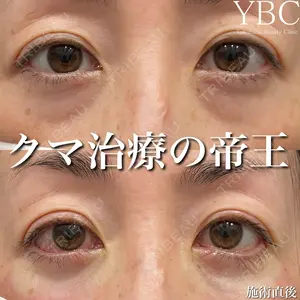 YBC横浜美容外科 大宮院 磯村 亮輔医師の症例