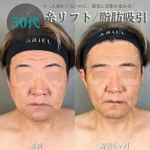 アリエル美容クリニック 水戸院 天白 典秀医師の症例